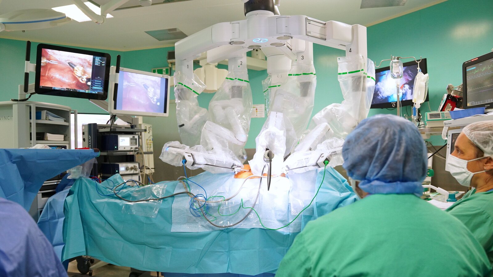 Jinnah Hospital Successfully Completes First Robotic Surgery