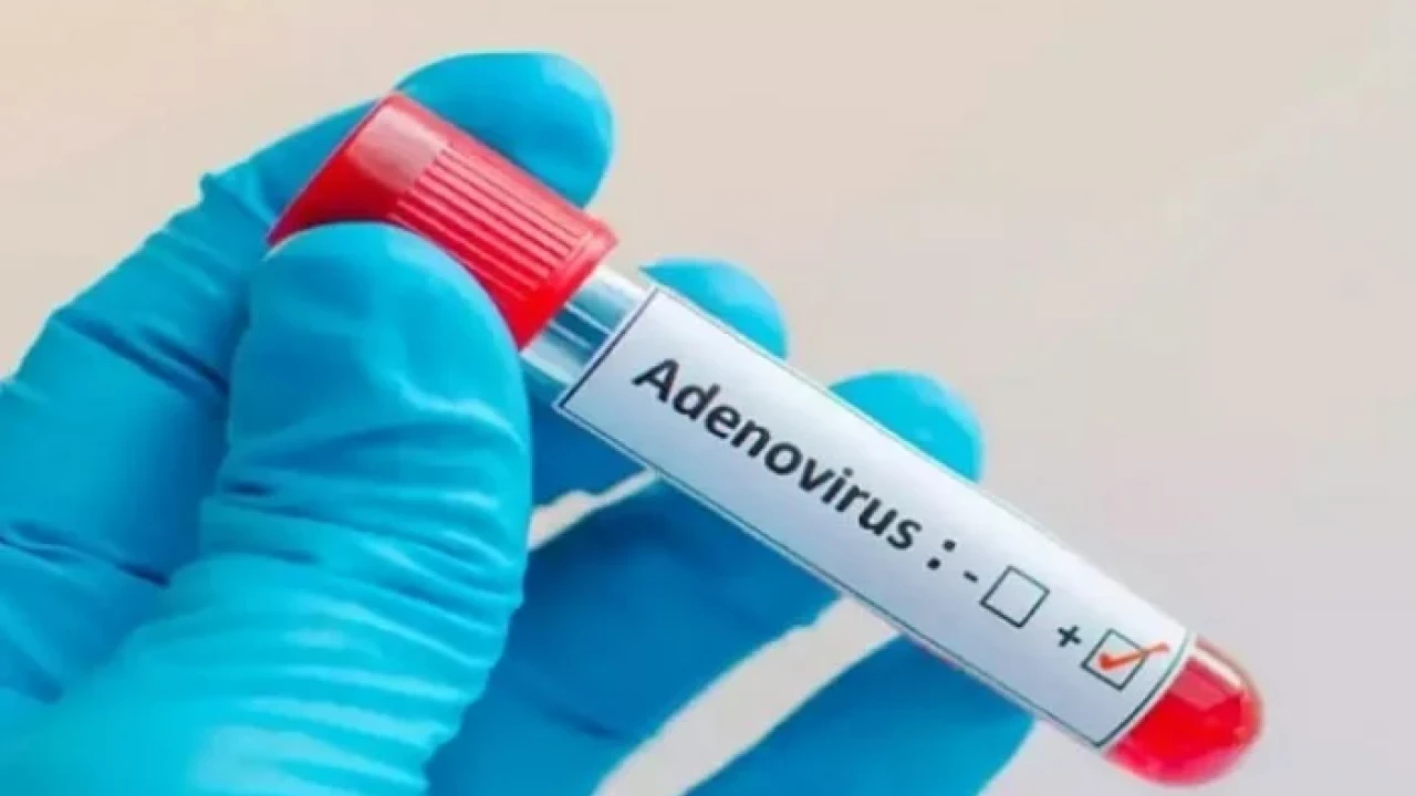 New Virus Spreading in Karachi: Symptoms and Precautions You Should Know!