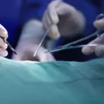 Woman Dies After Fake Doctor Performs Surgery Using YouTube Video