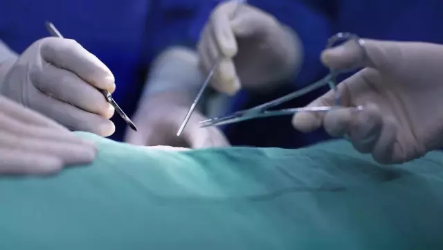 Woman Dies After Fake Doctor Performs Surgery Using YouTube Video