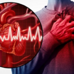 Karachi Heart Disease Increase Raises Alarm Across Pakistan